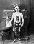 artificial-legs